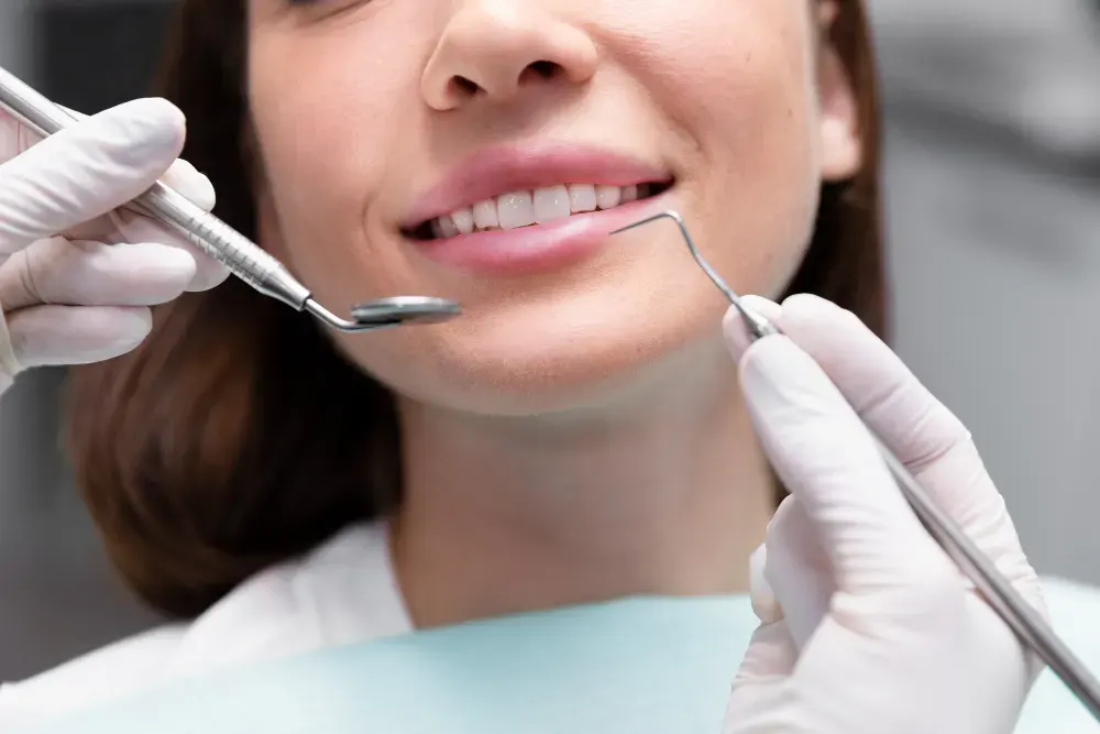 Composite Fillings