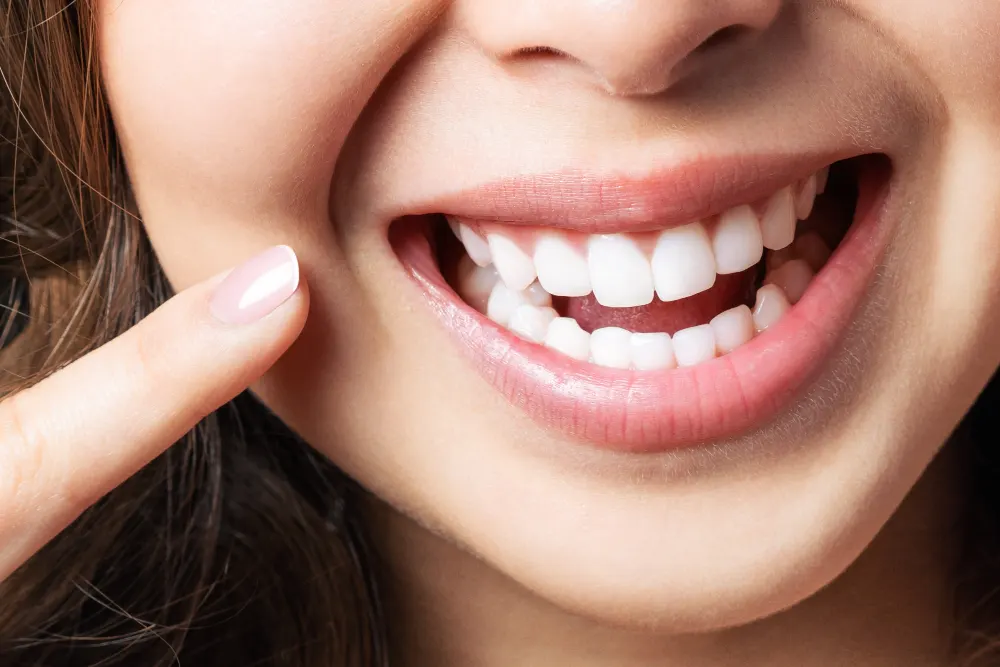 Teeth Whitening